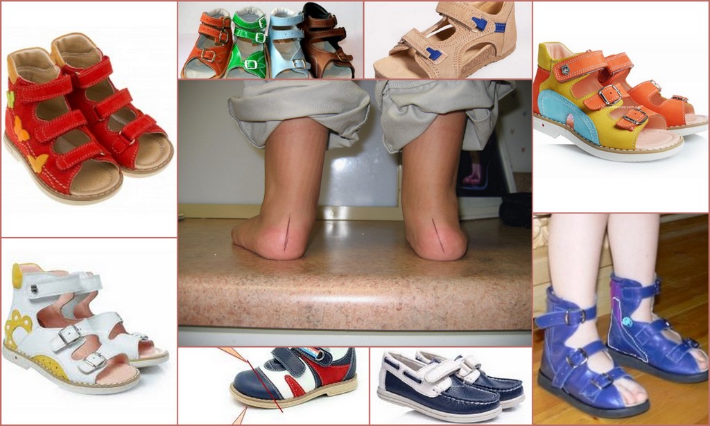 Польза и вред ортопедической обуви - статьи о здоровье на сайте магазина ортопедических товаров terrapevtika