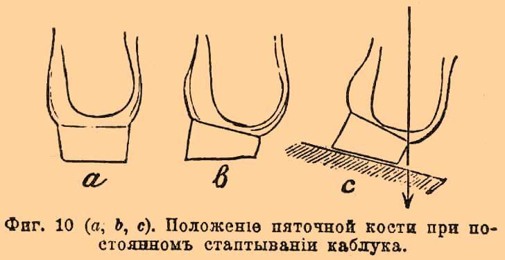 Почему стирается подошва? - сборник лучших советов