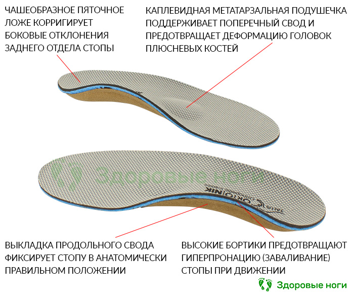 Ортопедические стельки презентация