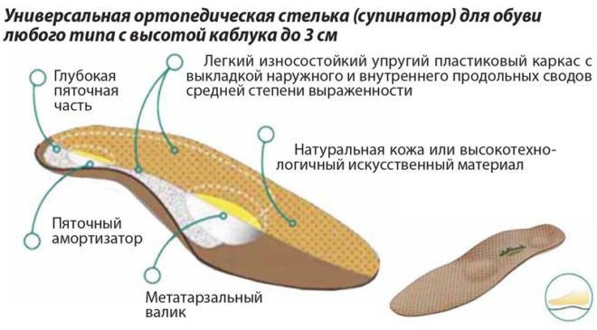 Что такое супинатор в обуви, его назначение и разновидности