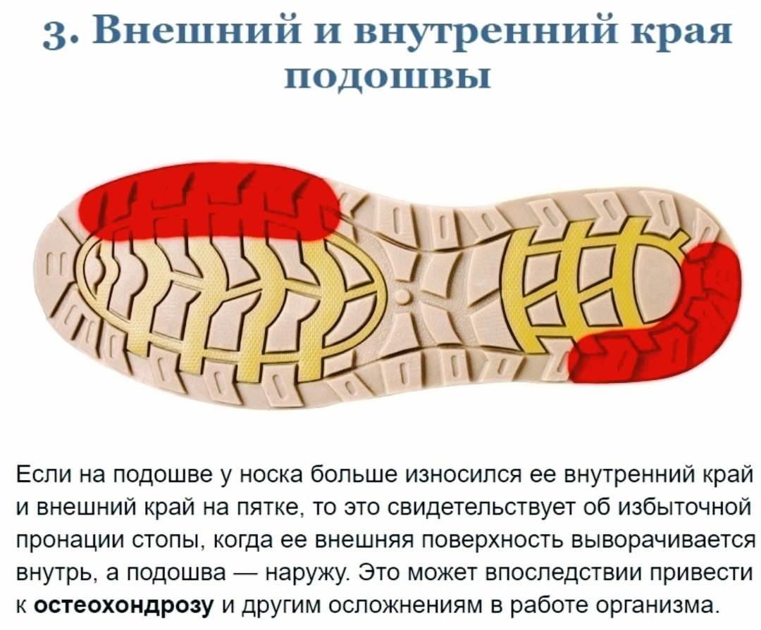 Почему топорщатся края обуви?