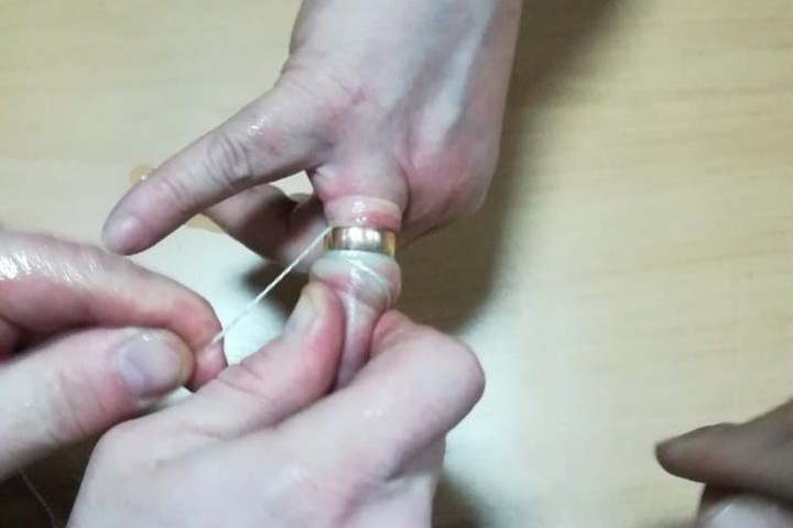 Как снять кольцо с опухшего пальца видео. Снятие кольца с пальца с помощью нитки. Как снять кольцо с опухшего пальца. Снять кольцо с отекшего пальца. Снять кольцо ниткой с опухшего пальца.