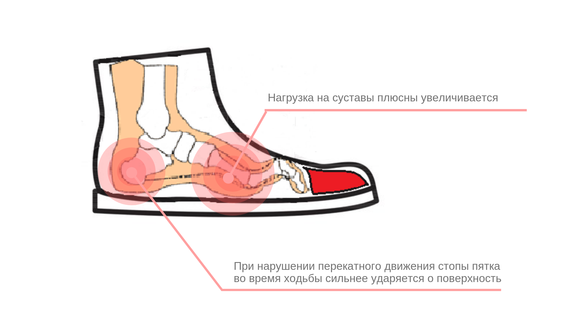 Как понять что обувь не по размеру